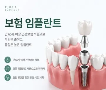 보험 임플란트